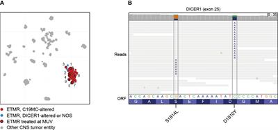 Potential Importance of Early Focal Radiotherapy Following Gross Total Resection for Long-Term Survival in Children With Embryonal Tumors With Multilayered Rosettes